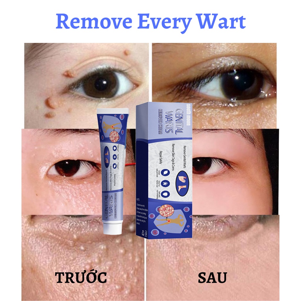 Kem loại bỏ mụn cóc SWEN chiết xuất từ thành phần tự nhiên thẩm thấu sâu phù hợp cho unisex | BigBuy360 - bigbuy360.vn