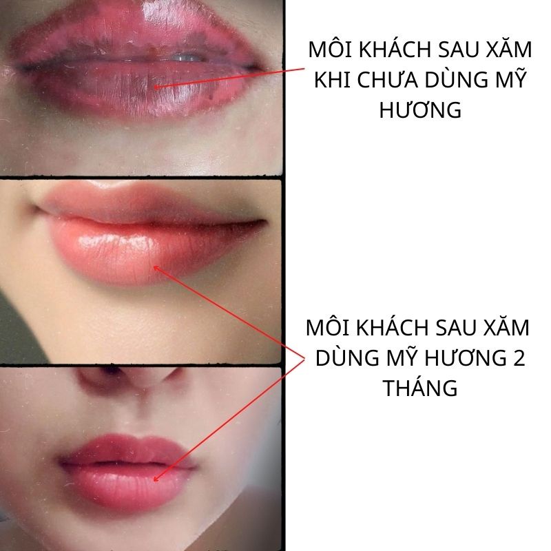 Gel dưỡng môi Mỹ Hương, dưỡng môi Mỹ Hương giúp môi mềm và lên màu đẹp sau phun săm