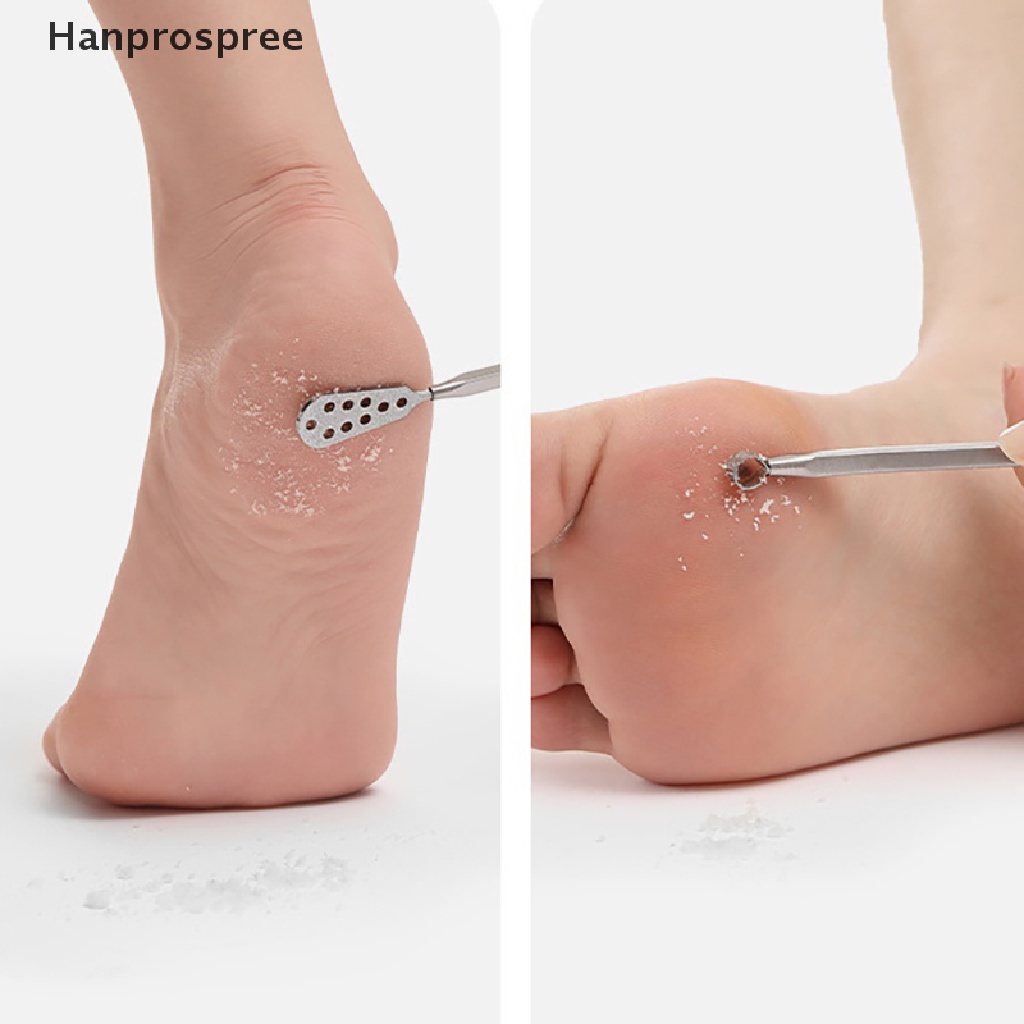 Dụng Cụ Tẩy Tế Bào Chết Cho Bàn Chân Bằng Thép Không Gỉ Hanprospree > Pro