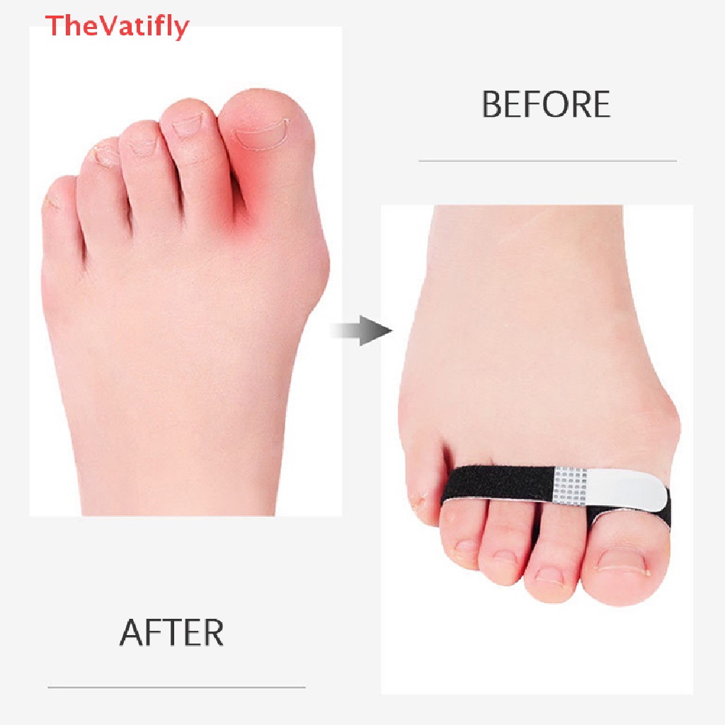 [TheVatifly] 1PC Toe Straightener Broken Toe Corrector Wraps s Hammer Splint Brace HOT