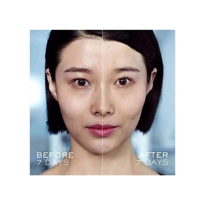 Set Dưỡng Lancome Genifique  NoBox