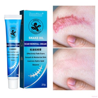 ♕Sumifun Kem Phục Hồi Sẹo Kem Phục Hồi Sẹo Kem Xóa Sẹo Phẫu Thuật Vết Sưng Rạn Da Mổ Lấy Thai Thuốc Mỡ Thảo Dược Chăm Sóc Cơ Thể Upbest 20G