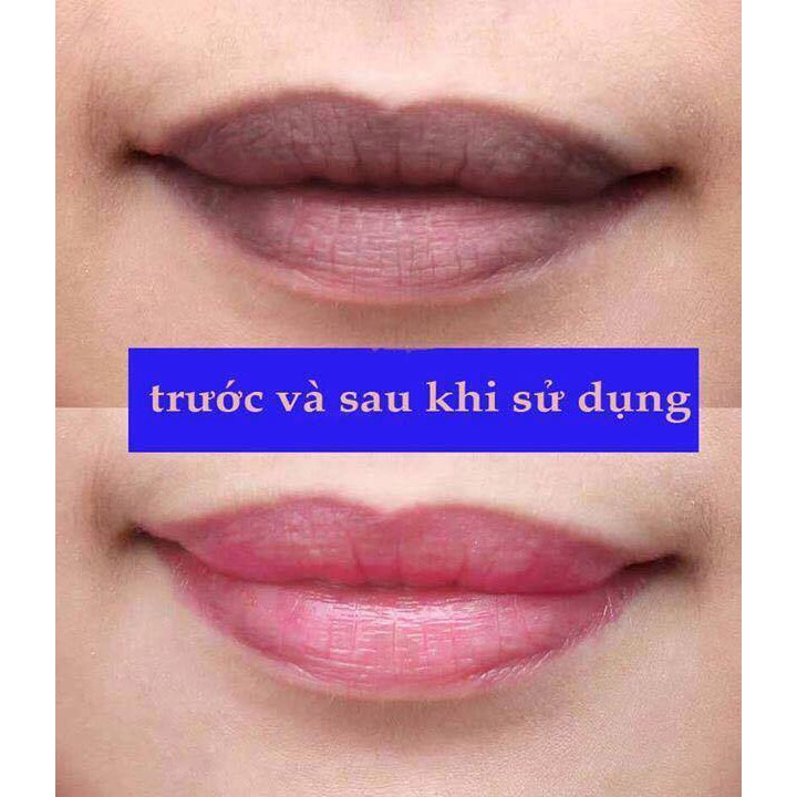 Son Dưỡng Mediheal dùng cho môi khô nứt nẻ, thâm, bợt màu, nhợt nhạt Mediheal Labocare Panteno Lips 10ml