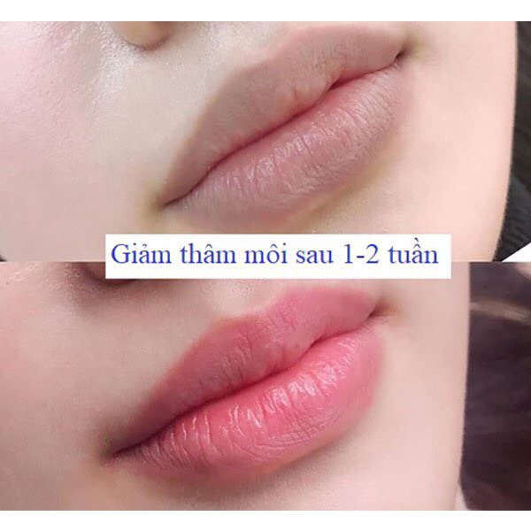 Dưỡng Môi Tẩy Môi collagen Hồng Tự Nhiên Giúp Môi Luôn Hồng Hào