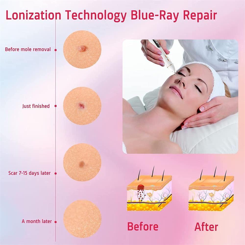 Bộ Dụng Cụ Chăm Sóc Da Làm Đẹp Dễ Sử Dụng Có Thể Điều Chỉnh Dành Cho Bạn Nữ