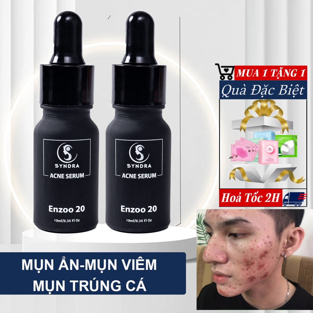 Serum ngừa mụn trứng cá mụn ẩn dưỡng sáng da mờ thâm