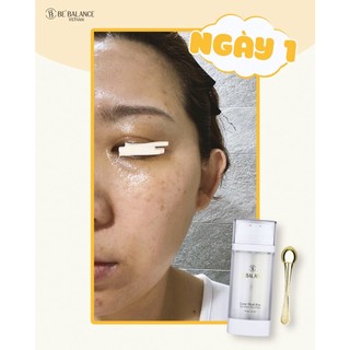 [HET HANG] Kem Mắt Be'Balance Luxe Dual Eye (30ml)