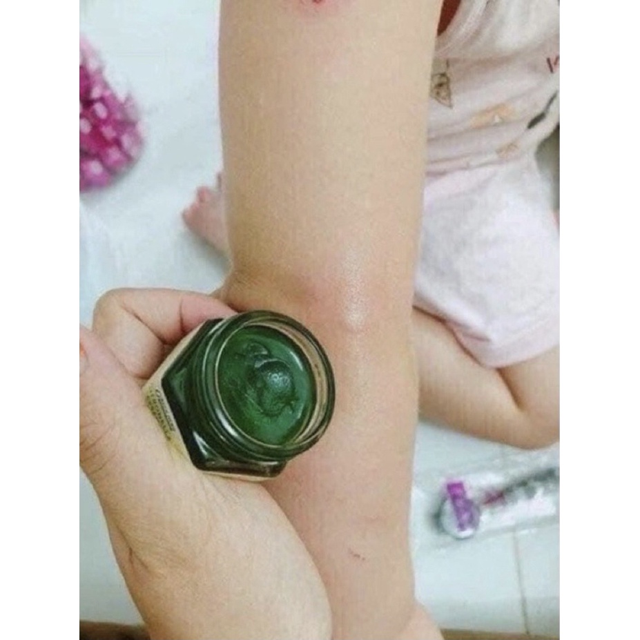 Dầu Cù Là Muỗi Sả Thái Lan Chống Muỗi Đốt Côn Trùng Cắn 20g