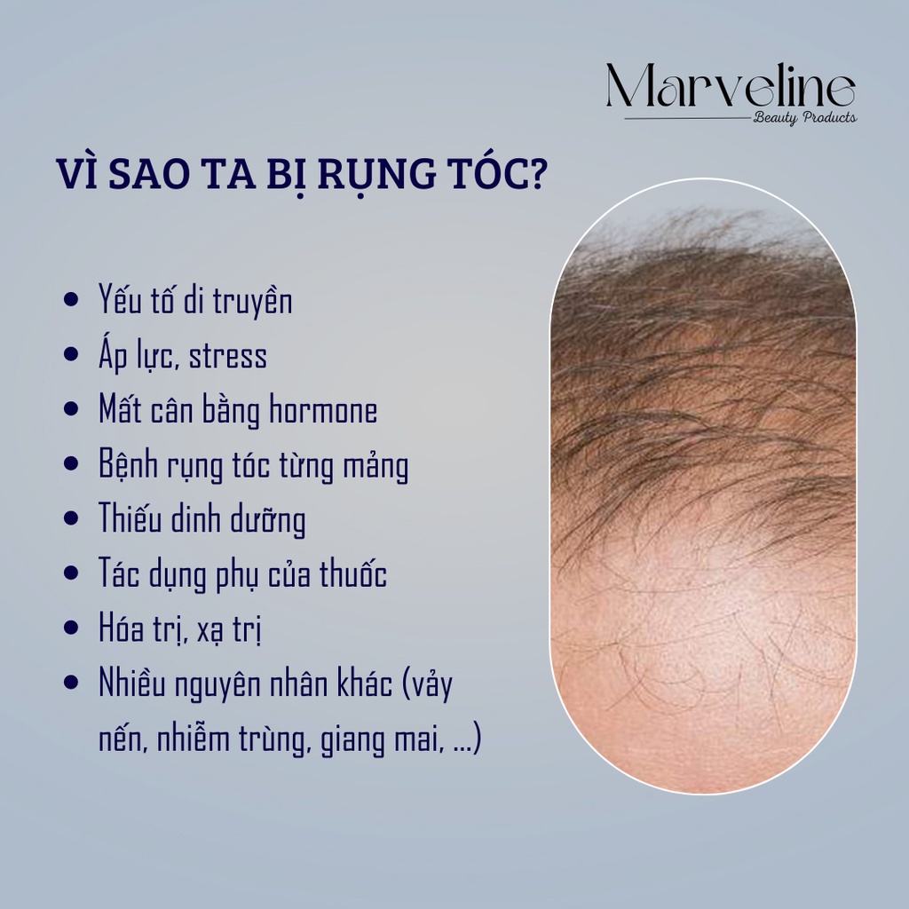 Serum mọc tóc công thức mạnh Mỹ Aveline Hair Regrowth Treatment