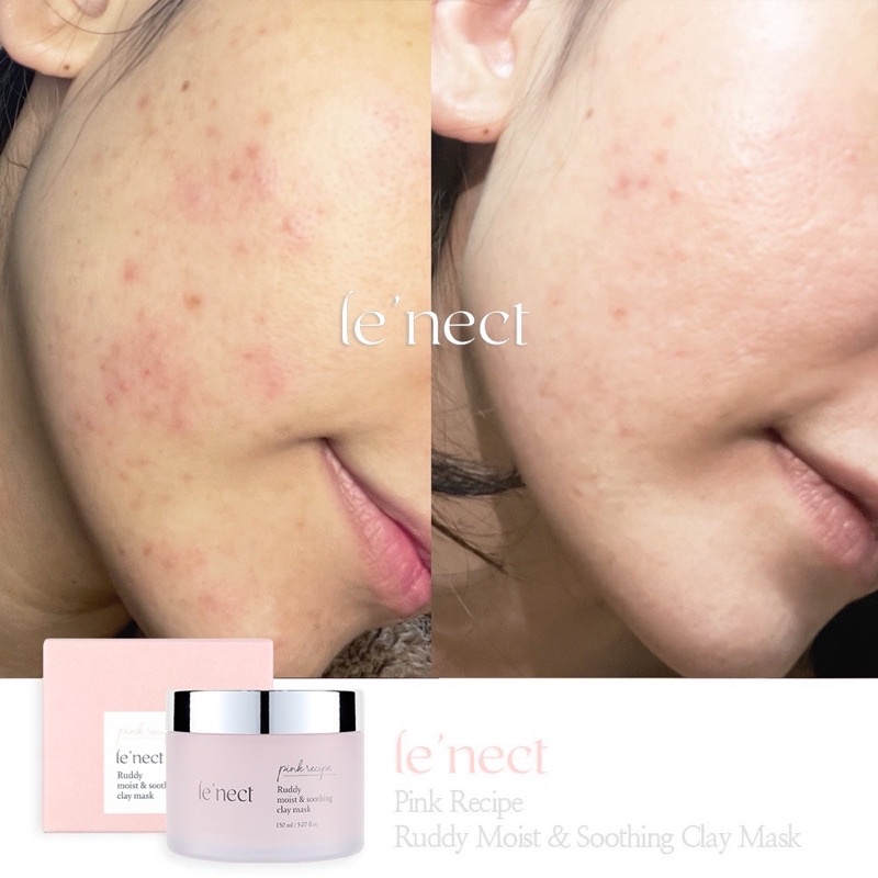 Mặt Nạ Bùn Chiết Xuất Nhựa Huyết Rồng Pink Recipe - Cho Da Khô, Lão Hóa, Tổn Thương