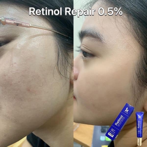 Kem Retinol K Lady Care 0.5% Hàn Quốc Kem Dưỡng Retinol Giữ Ẩm Căng Bóng Da Chuẩn Hàn Quốc