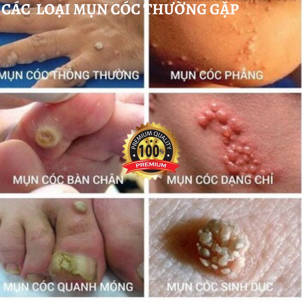 Kem loại bỏ mụn cóc SWEN chiết xuất từ thành phần tự nhiên thẩm thấu sâu phù hợp cho unisex | BigBuy360 - bigbuy360.vn