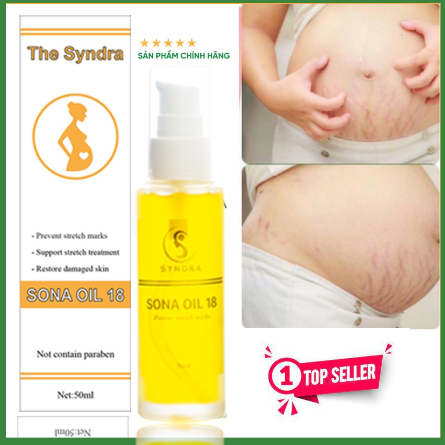 Dầu rạn da cho phụ nữ sau sinh- Sona oil 50ml,Tác dụng nhanh lành tính