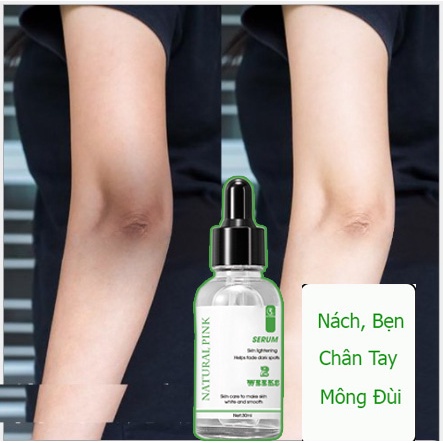 Serum  Thâm Nách Bẹn Chân Tay Đầu Gối Dưỡng Ẩm Làm Sáng Da 30ml