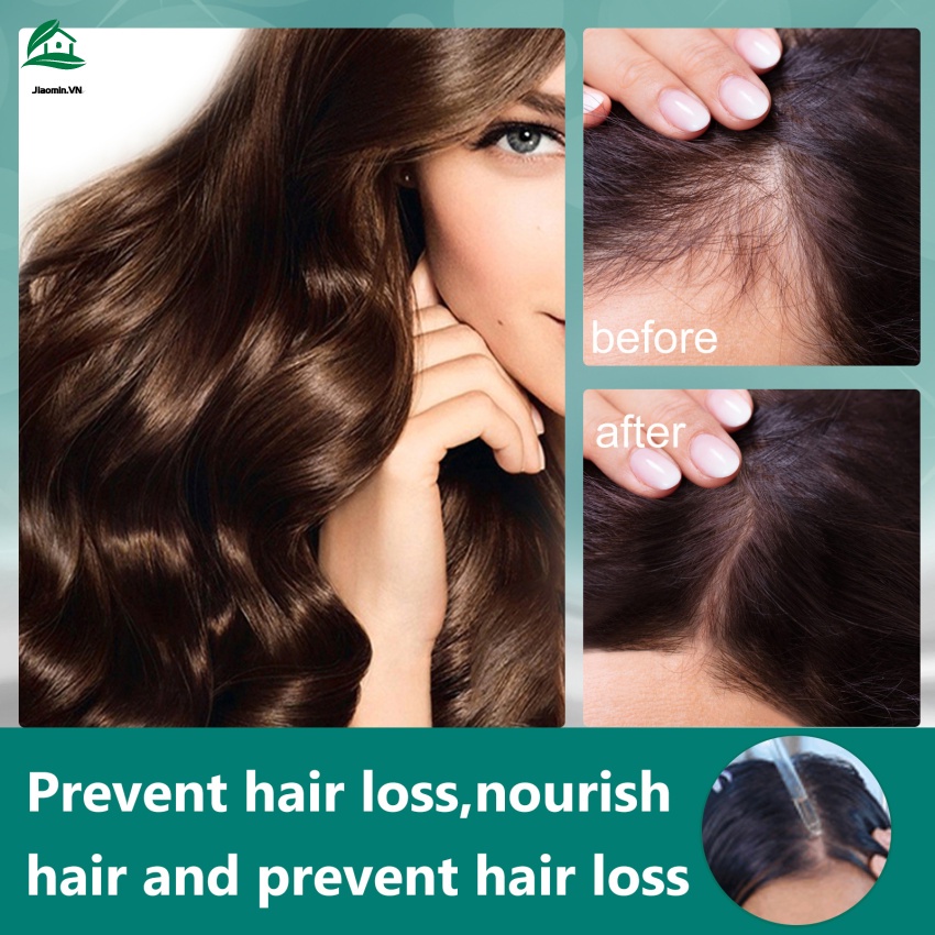 Tinh chất kích thích mọc tóc tự nhiên 30ml chất lượng