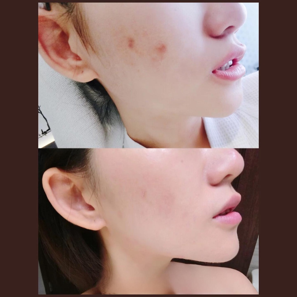 Set dưỡng da Lancome Glowing In Genifique 2Pc Set