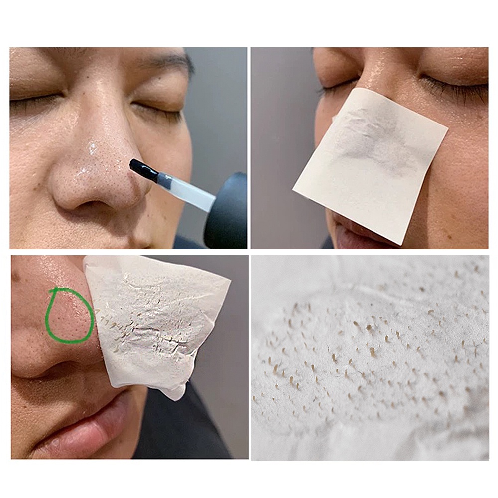 Bộ sản phẩm BREYLEE loại bỏ mụn đầu đen 17ml*2 chất lượng cao tiện dụng