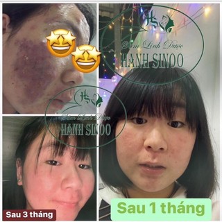 Tái tạo da sâm linh dược ( không bột - mạnh)