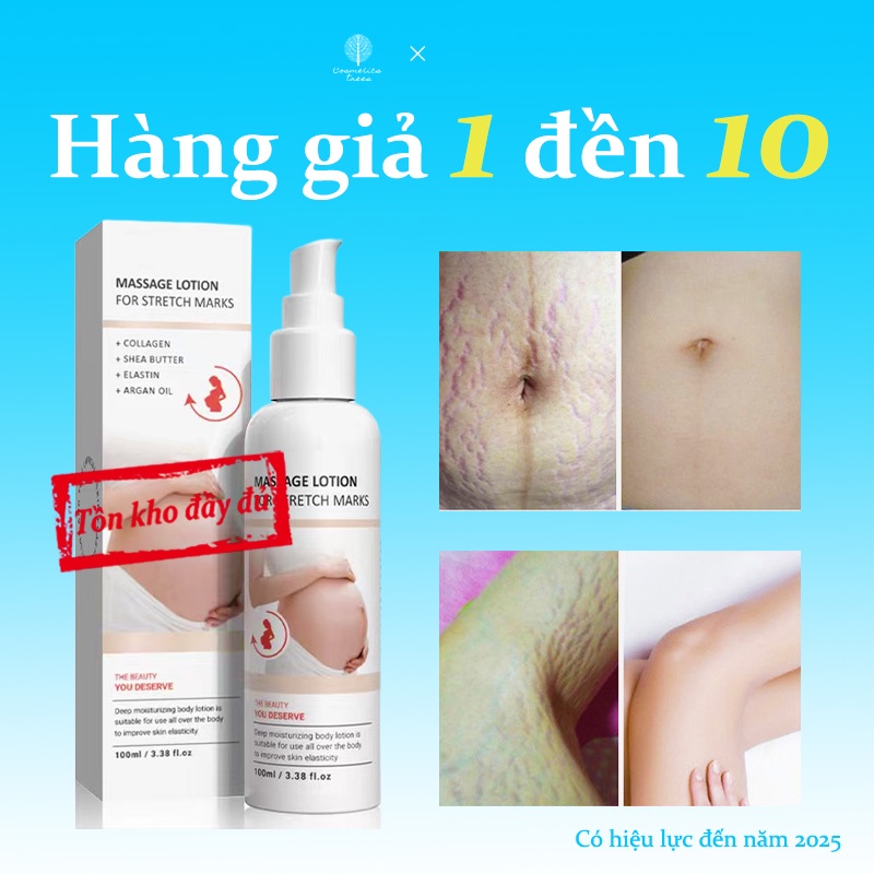 Kem dưỡng da trị rạn da QEM 100ml Khắc phục rạn da, sẹo sau sinh