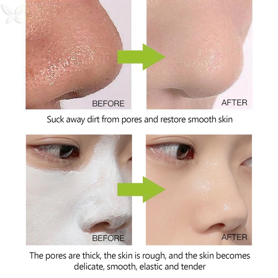 Mặt nạ bùn trà xanh vovigo JMMZ 120g làm trắng dưỡng ẩm giảm mụn đầu đen kiềm dầu