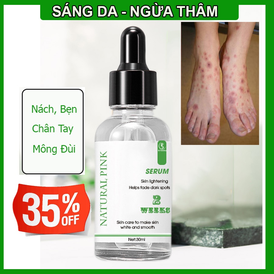 Serum Ngừa Thâm Nách Mông Bẹn - Thâm Chân Tay Lưng Đầu Gối Dưỡng Sáng Da Mờ 30ml