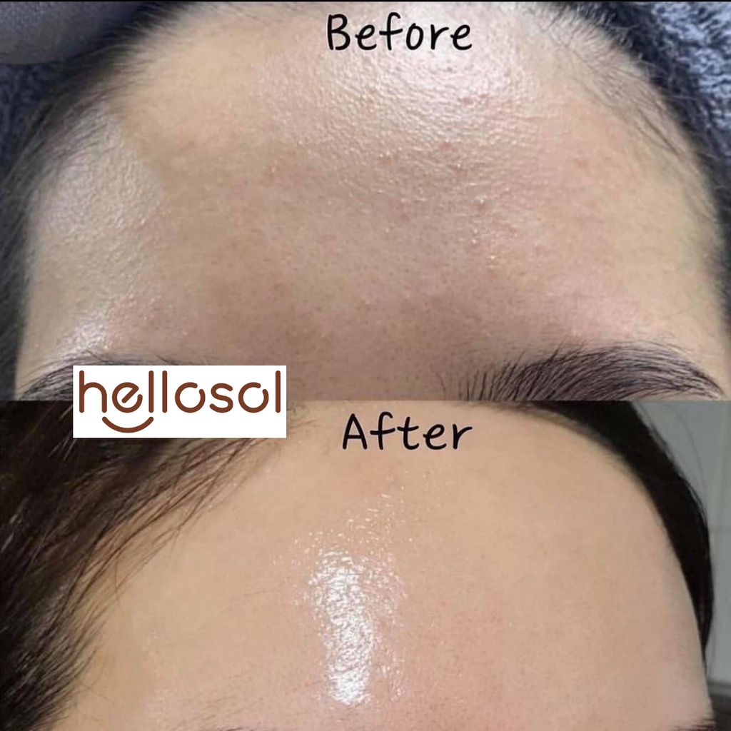 Serum Vitamin B5 10% của Vlenn