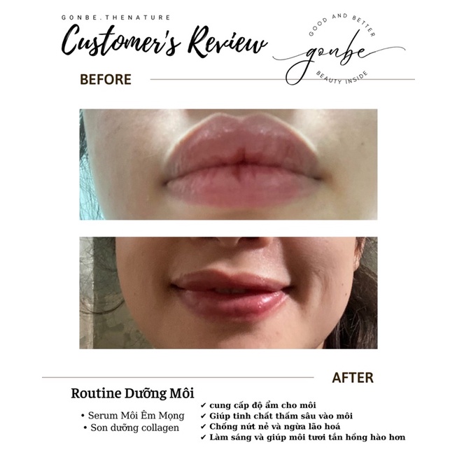SERUM DƯỠNG MÔI / 𝑬̂𝒎 𝑴𝒐̣𝒏𝒈