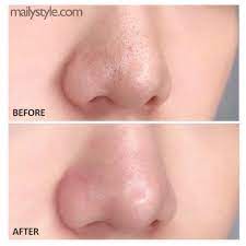 Tẩy Da Chết Từ Lợi Khuẩn Lên Men Bí Đỏ Peacholic