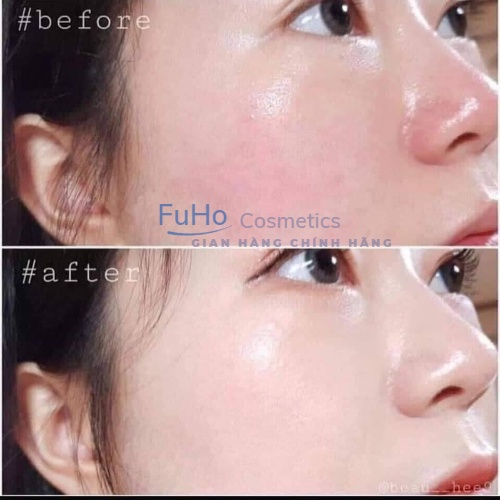 Serum cấp nước OZ Filler Aqua dưỡng ẩm Giúp căng bóng chống nhăn da Fuhocosmetics | BigBuy360 - bigbuy360.vn