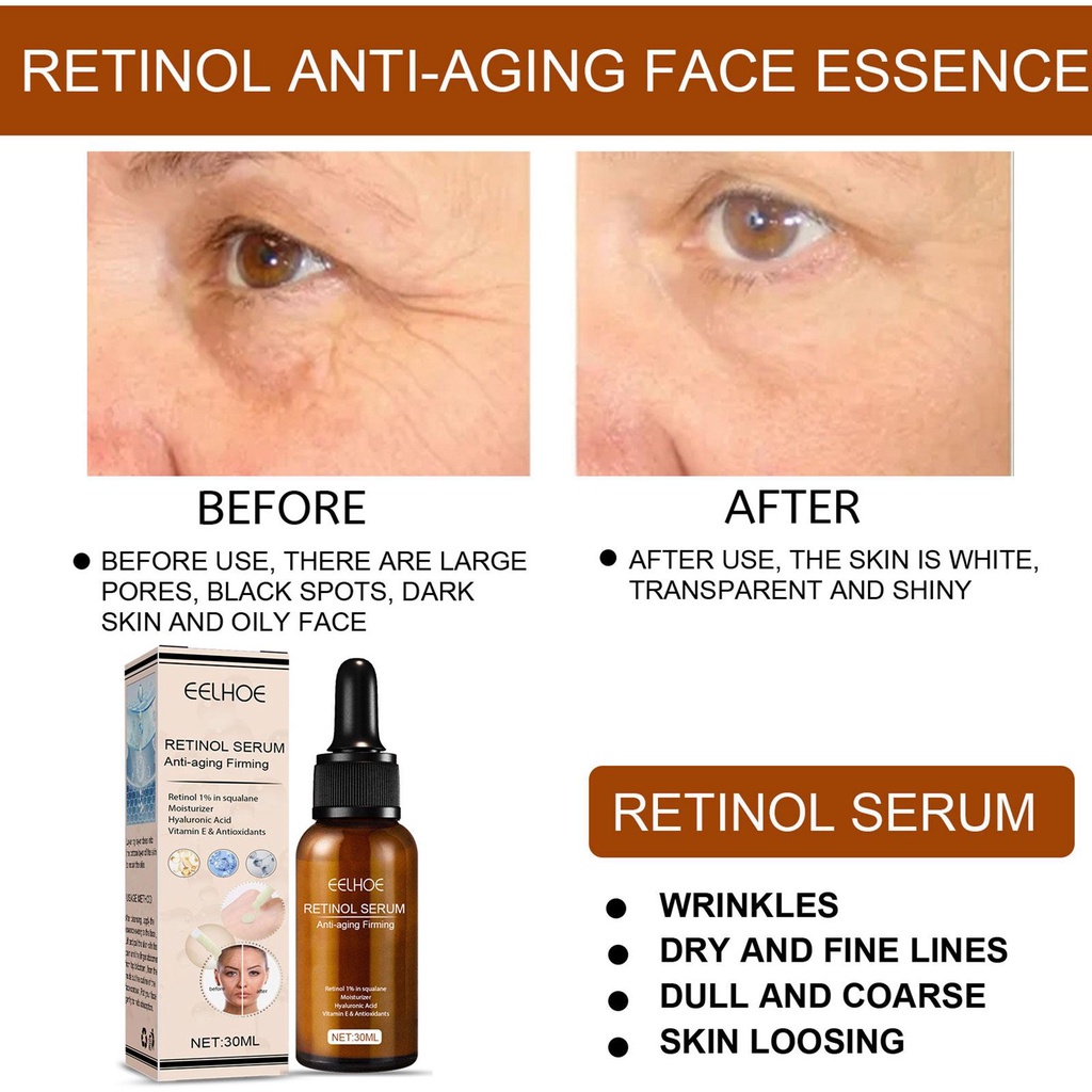 Serum Retinol 30ml Chống Lão Hóa Làm Săn Chắc Da W4K4