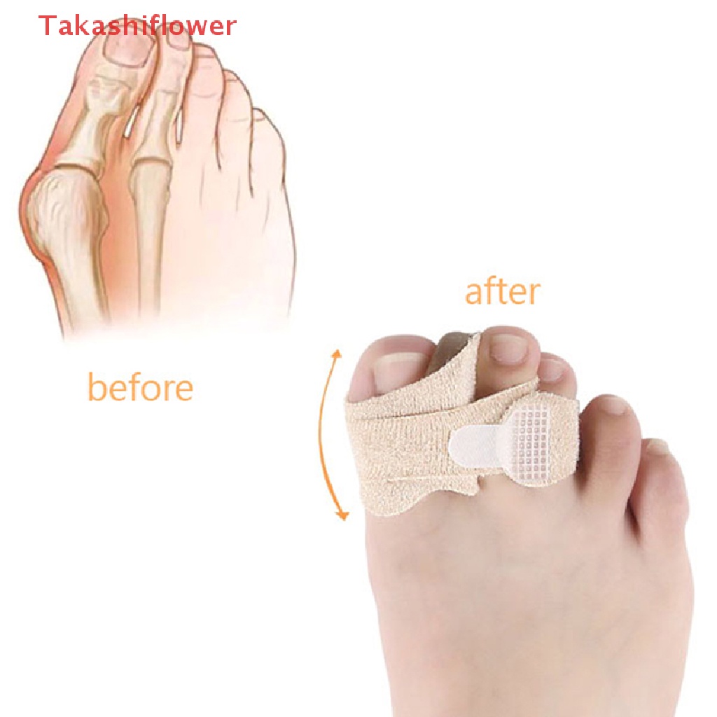 Set 1 / 2 Cặp Dụng Cụ Chỉnh Hình Ngón Chân Chăm Sóc Chân