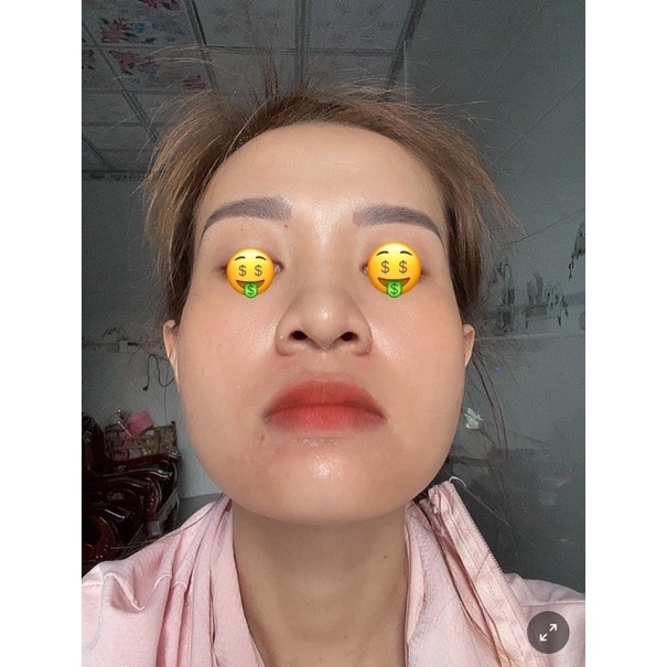 Combo peel da nhân sâm và b5 phục hồi huyền phi