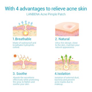 Miếng dán mụn Lanbena Breylee Acne Pimple Patch