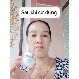 Kem dưỡng cấy trắng da ( tặng kèm serum ).