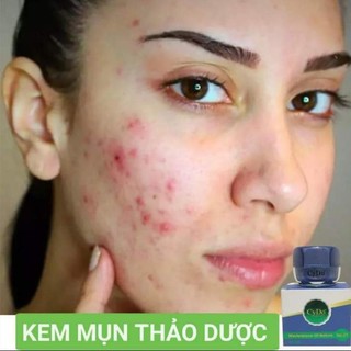 KEM CYDO MỤN THẢO DƯỢC 12g