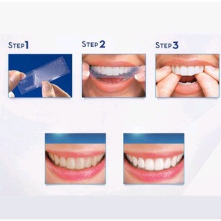 Miếng dán làm trắng răng 3d tiện dụng