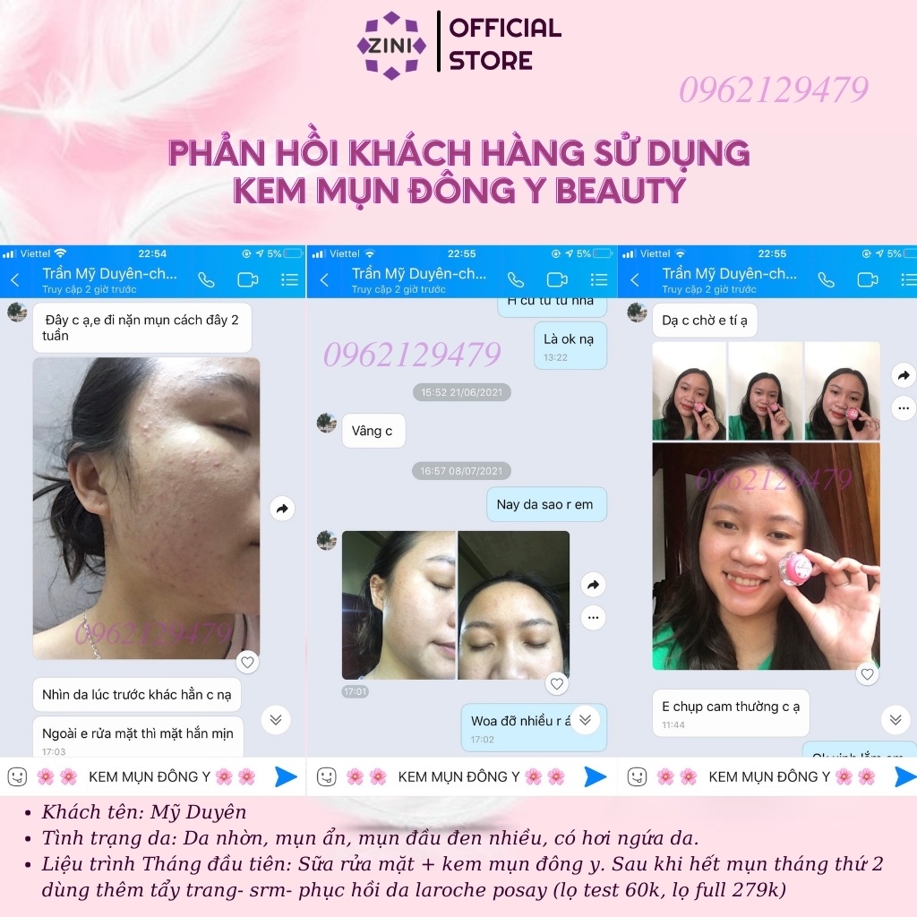 Combo dưỡng da chống nắng sạch mụn hoa anh đào, mờ vết thâm, sạch nám ZINI STORE