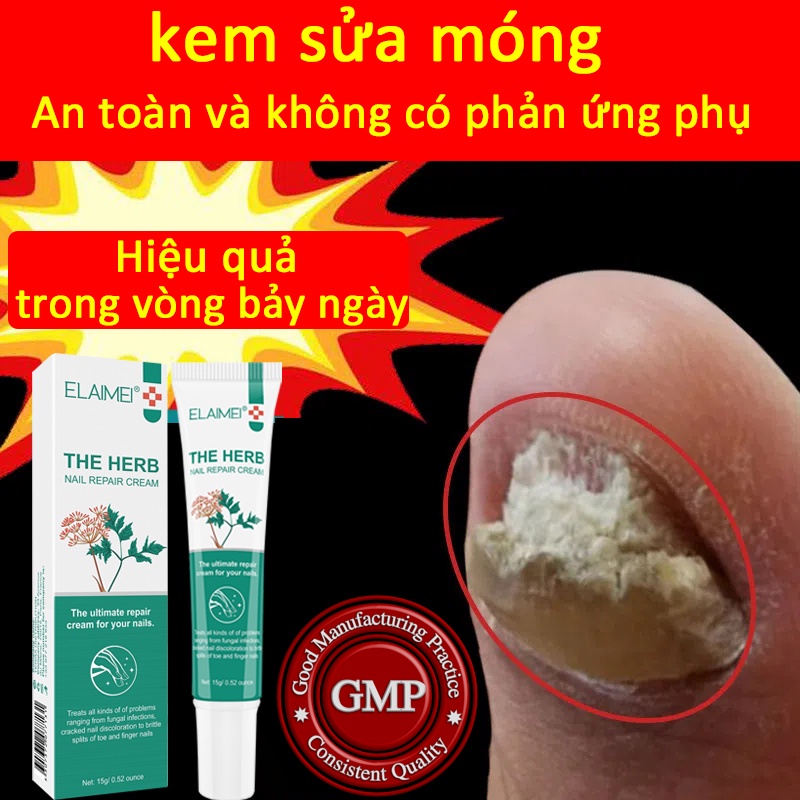 Kem Dưỡng Móng Tay Phục Hồi móng chân móng tay 15g Cải thiện vết nứt móng tay Kháng khuẩn Sửa chữa vết nứt móng tay
