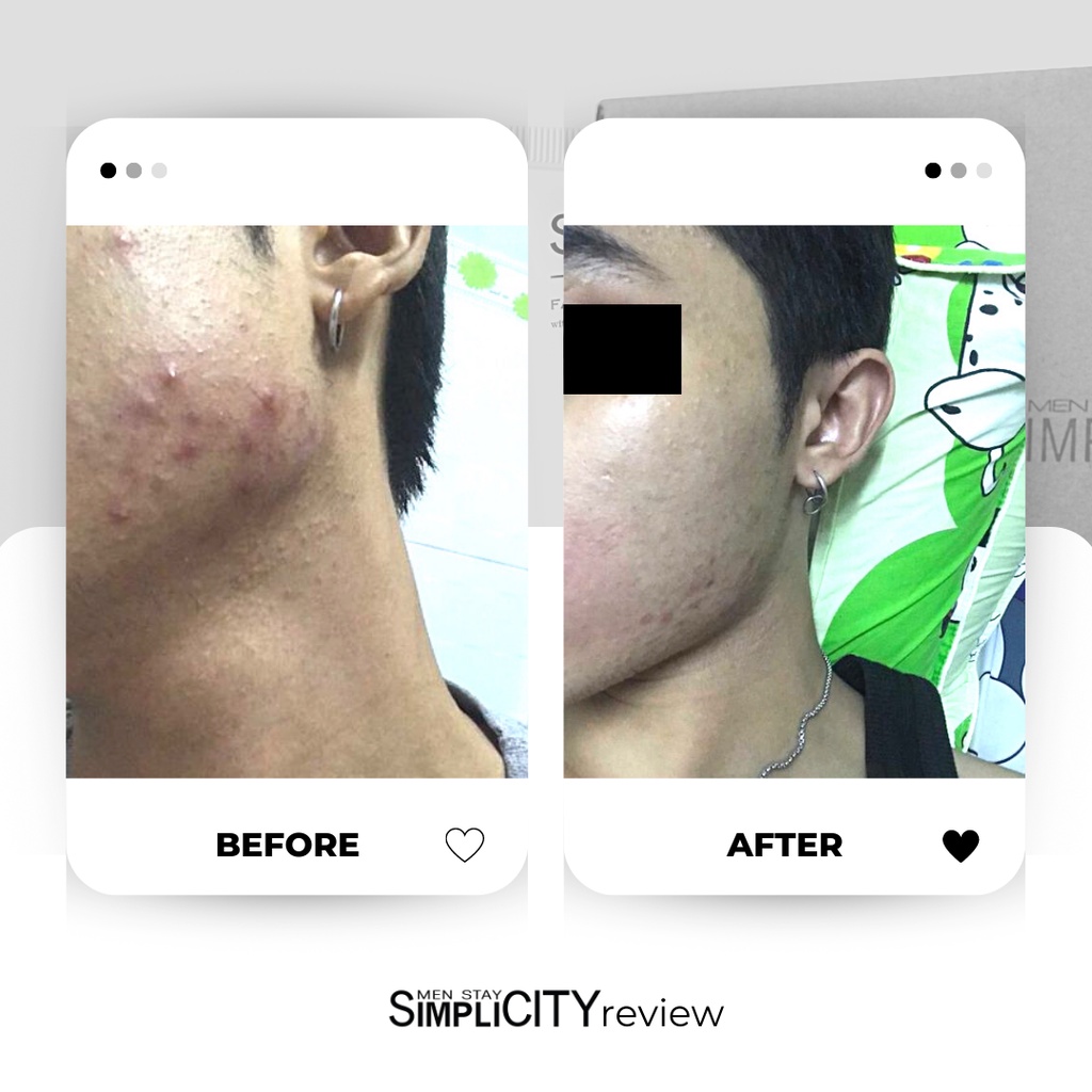 Serum giảm mụn & làm dịu da cho nam Men Stay Simplicity Calm Skin Relief Facial Serum 10ml