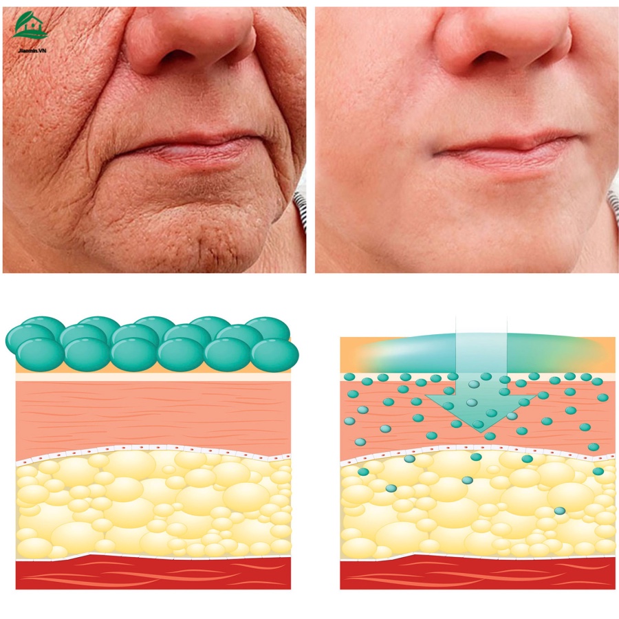 Tinh Chất Axit Hyaluronic Và Vitamin C Giúp Se Khít Lỗ Chân Lông Và Làm Trắng Da Hiệu Quả