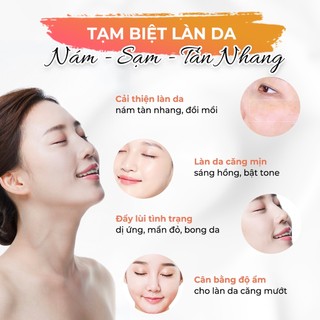 Kem Nám Tàn Nhang Face Luxury