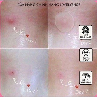 Miếng dán mụn 8mm 64 miếng Hàn quốc