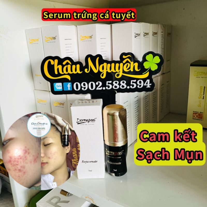 Serum trứng cá tuyết. Xóa tất cả các loại mụn. Tphcm giao trong ngày.