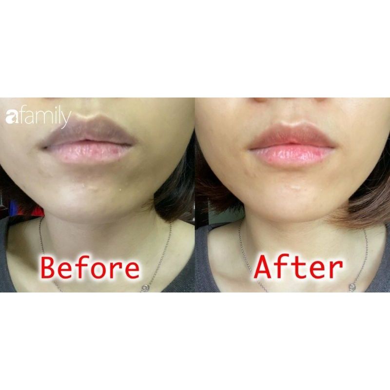 Dưỡng Môi Tẩy Môi collagen Hồng Tự Nhiên Giúp Môi Luôn Hồng Hào