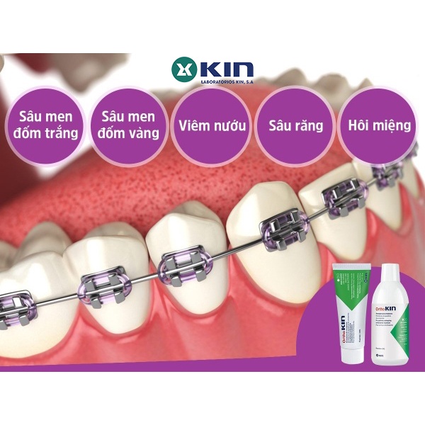 Kem Đánh Răng Ortho Kin Cho Răng Niềng, Chỉnh Nha Chăm Sóc Chuyên Biệt 75ml