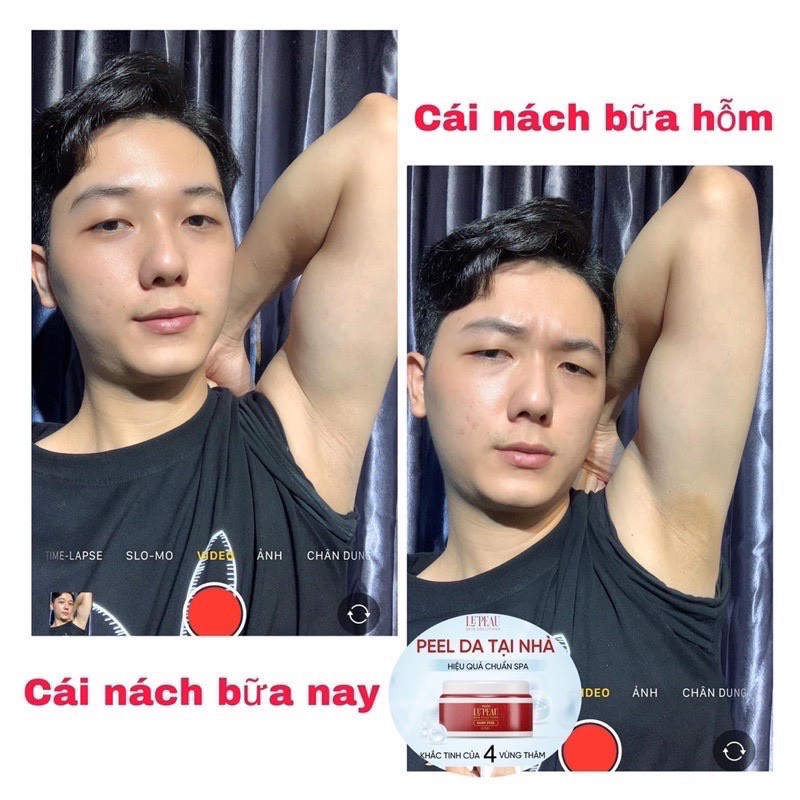 - Kem bong da, Peel nách Retinol, peel chân, peel body, khử thâm làm trắng da toàn thân Lepeau - chính hãng