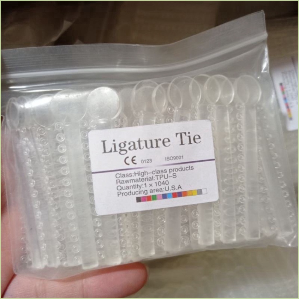 Chun đơn chỉnh nha , chun tại chỗ niềng răng - NHA KHOA HÀ NỘI