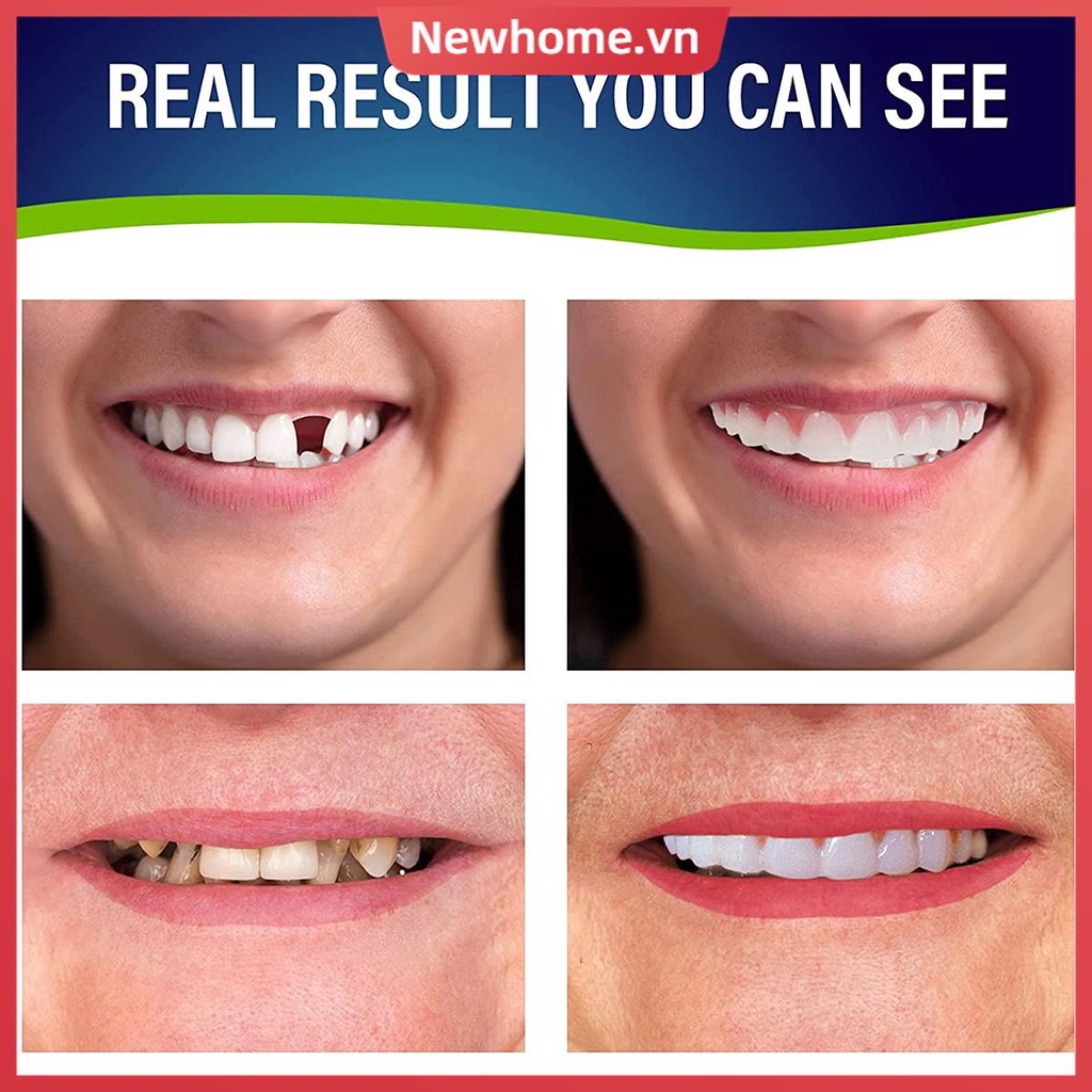 Hàm Răng Giả Thoải Mái Cho Niềng Răng Giả Shop Tkc4315