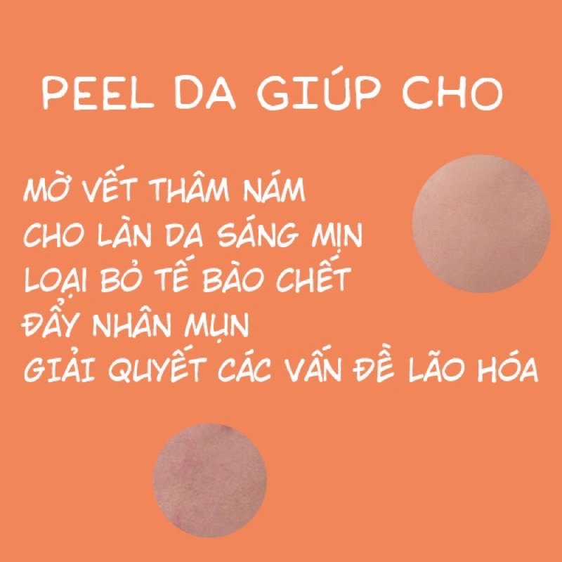 [1ml] TCA peel da 15%