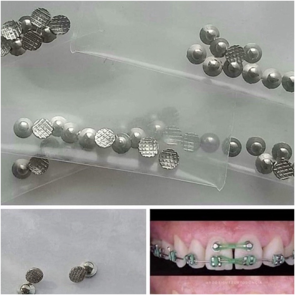 Set 10 cái Button chỉnh trục răng Button chỉnh nha núm tròn chỉnh nha -LC01